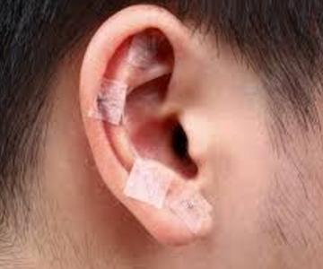 Ear Seeds