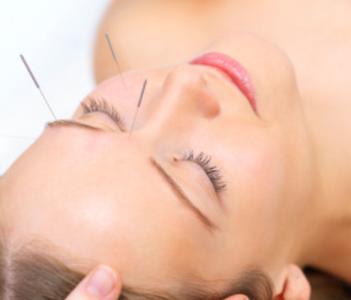 Acupuncture treatment